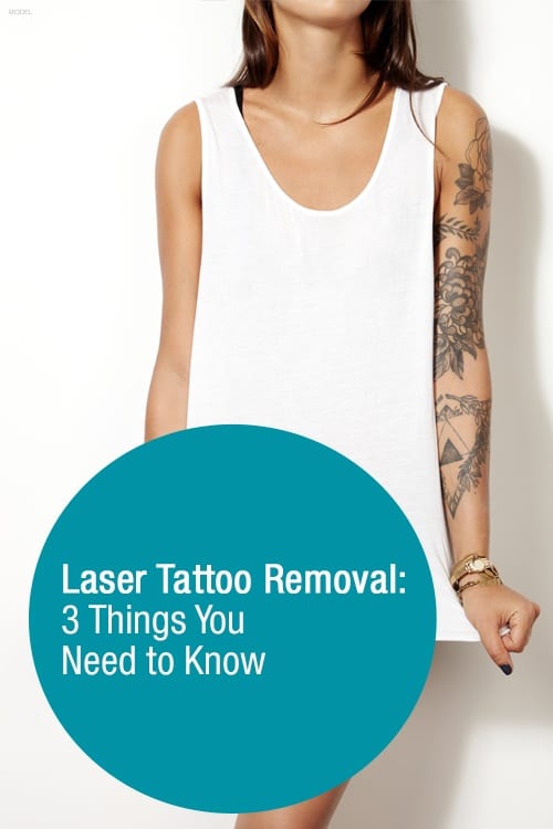 Tattoo removal recommendations  rmadisonwi